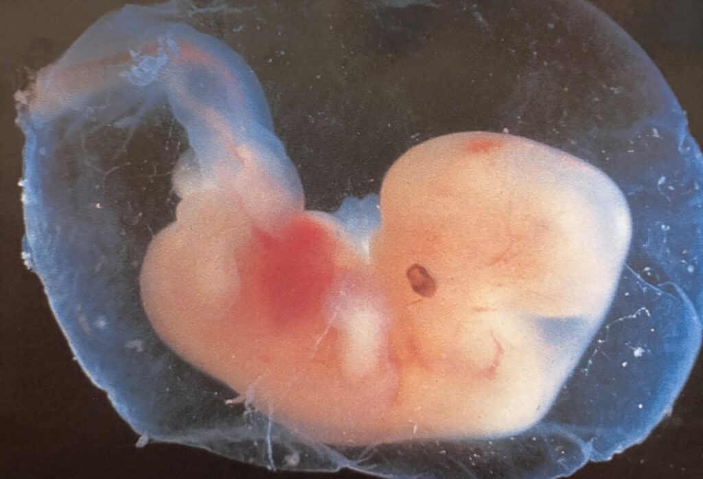 Płód w 6. tygodniu ciąży – ilustracja rozwoju dziecka