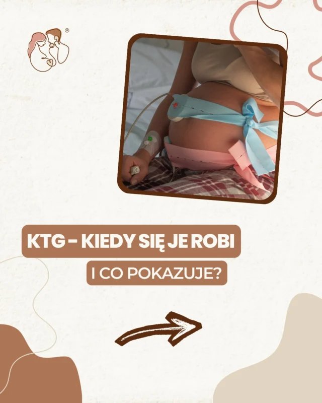 KTG - to jedno z najczęściej wykonywanych badań pod koniec ciąży 🤰 Dzięki KTG można sprawdzić, jak dziecko reaguje na skurcze i czy czuje się dobrze w brzuchu mamy 👶🤎Badanie jest:✨ bezbolesne✨ nieinwazyjne✨ bezpieczne dla mamy i dziecka❗️Pamiętaj – wynik KTG zawsze interpretuje specjalista, biorąc pod uwagę cały obraz ciąży.Masz już za sobą pierwsze KTG? Podziel się doświadczeniem 👇#halobrzuszek #ktg #ciąża #poród #bedemama #rodzew2026